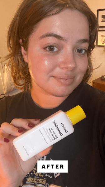 Hoffmann after applying the Dr. Jart Ceramidin Skin Barrier Serum Toner